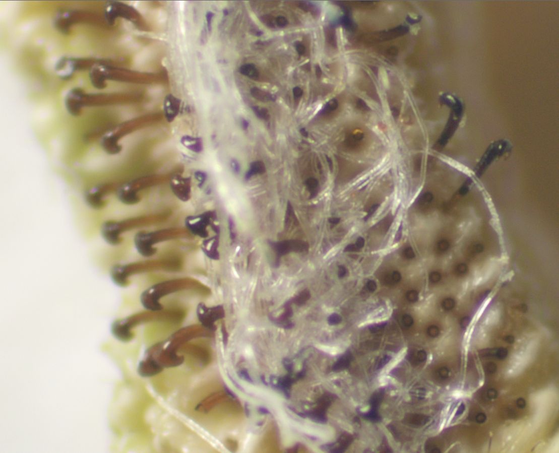 Cremaster up close